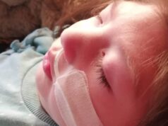 Niña de Gorbea con Microcefalia Necesita Recursos Para Costear Exámenes Médicos