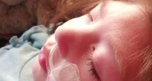 Niña de Gorbea con Microcefalia Necesita Recursos Para Costear Exámenes Médicos