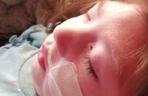 Niña de Gorbea con Microcefalia Necesita Recursos Para Costear Exámenes Médicos