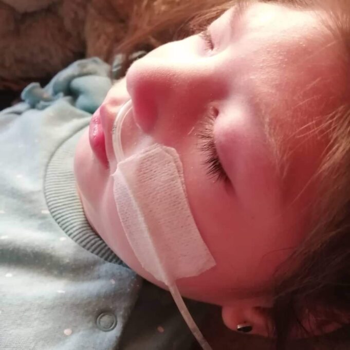 Niña de Gorbea con Microcefalia Necesita Recursos Para Costear Exámenes Médicos