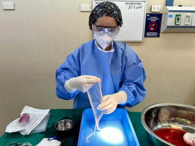 El Hospital regional de Temuco realiza un hito clínico al separar la membrana amniótica de una placenta para fines médicos