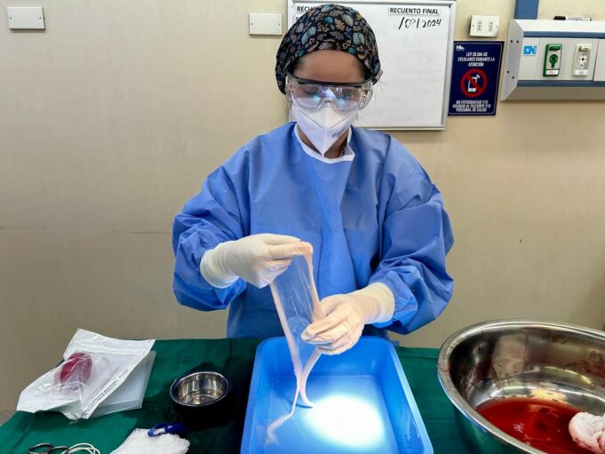 El Hospital regional de Temuco realiza un hito clínico al separar la membrana amniótica de una placenta para fines médicos