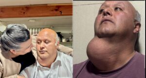 Tras viralización de su caso: vecino de la comuna de Victoria será operado tras 17 años de espera