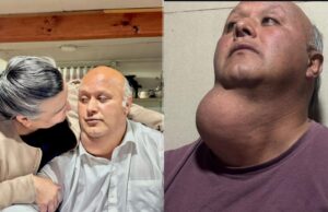 Tras viralización de su caso: vecino de la comuna de Victoria será operado tras 17 años de espera