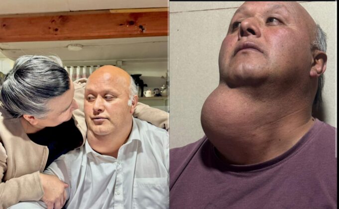 Tras viralización de su caso: vecino de la comuna de Victoria será operado tras 17 años de espera