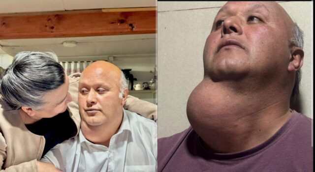 “Buscamos dignidad”: familia de Selva Oscura denuncia espera de más de 15 años por cirugía en hospital regional de Temuco