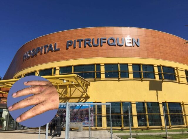 Al menos 8 funcionarias del hospital de Pitrufquén estarían contagiadas de sarna y acusan inacción del establecimiento