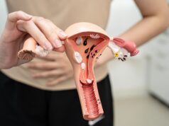 Cáncer de ovario: 7 de cada 10 casos se detectan tarde