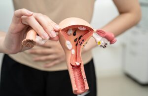 Cáncer de ovario: 7 de cada 10 casos se detectan tarde