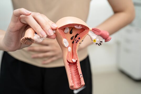 Cáncer de ovario: 7 de cada 10 casos se detectan tarde