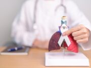Cáncer de pulmón: la enfermedad que provoca 10 muertes diarias en Chile y que en más del 80% de los casos se detecta tarde