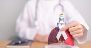 Cáncer de pulmón: la enfermedad que provoca 10 muertes diarias en Chile y que en más del 80% de los casos se detecta tarde