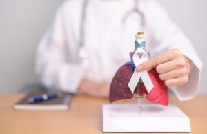 Cáncer de pulmón: la enfermedad que provoca 10 muertes diarias en Chile y que en más del 80% de los casos se detecta tarde