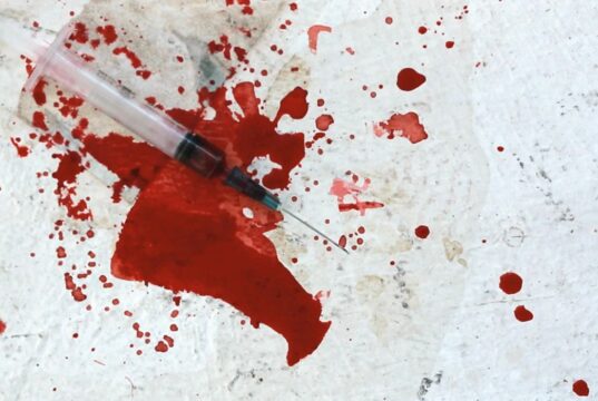 ¡Preocupante! Recolector terminó herido por jeringa que estaba en una bolsa de basura en Victoria